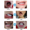 An effective tool for whitening and removing tartar!